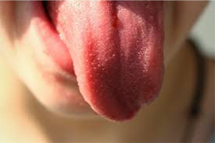 Our+taste+and+smell+might+be+linked+more+to+our+tongue+than+our+brain.+